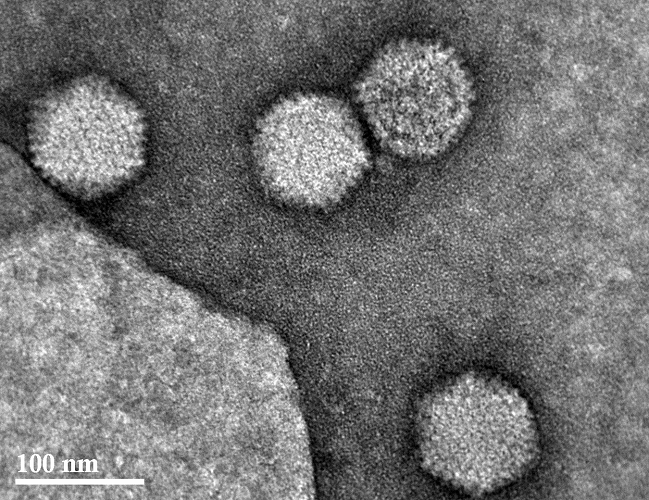 Adenovirus​