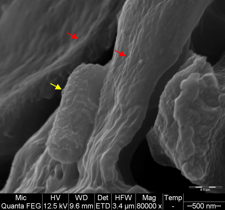 Scanning Electron Microscopy of a B. anthracis cell in the rabbit lung that succumbed to infection. The bacteria is marked with