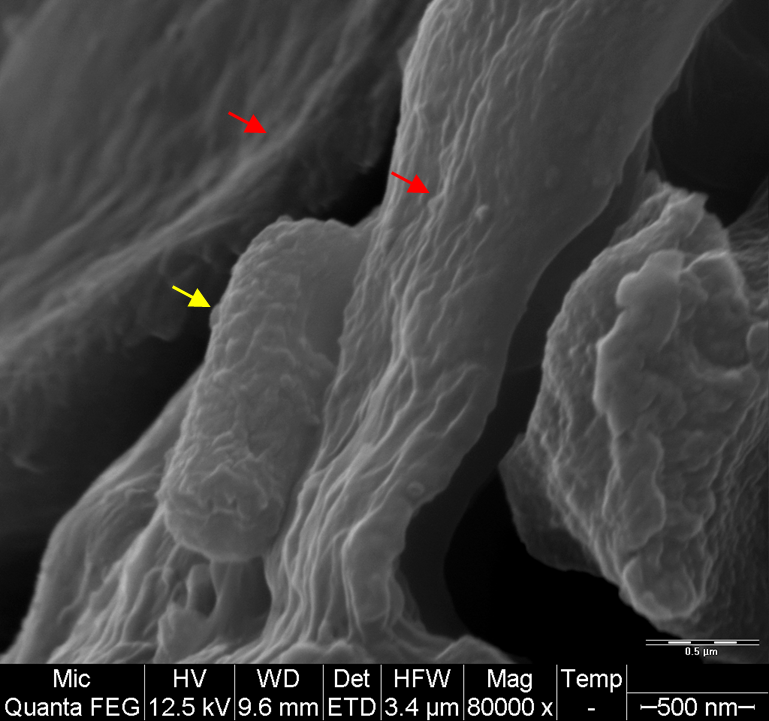 Scanning ​Electron Microscopy of a B. anthracis cell in the rabbit lung that succumbed to infection. The bacteria is marked with