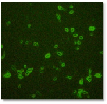 Yersinia pestis IFA staining of the F1 capsule